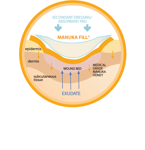Manuka-Fill-Illustration